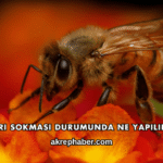 Arı Sokması Durumunda Ne Yapılır