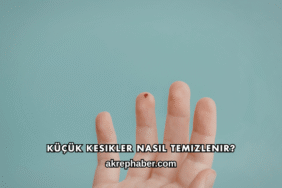 Küçük Kesikler Nasıl Temizlenir?