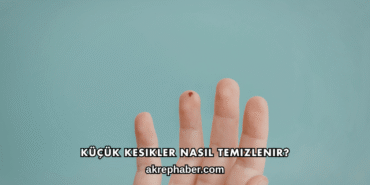 Küçük Kesikler Nasıl Temizlenir?